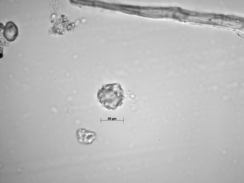 Palma. Fitolito Palma Arecaceae.&nbsp;Sitio La Mikela (Pereira), mano de molienda,&nbsp; nivel 9 (no datado).&nbsp;&nbsp;Francisco Javier Aceituno (fotos personales, Laboratorio de Arqueología, Universidad de Antioquia).