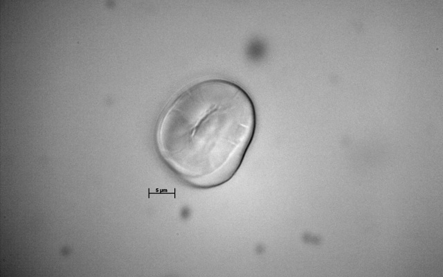 Microfotografía de hallazgo arqueobotánico leguminosa
