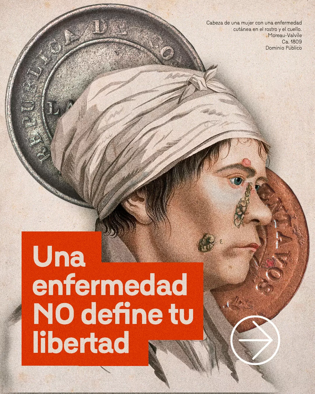 Retrato de una mujer con una enfermedad en el rostro y cuello 